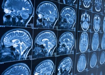 Diferencias entre Parkinson y temblor esencial: cómo identificar cada uno y cuándo acudir al médico