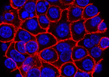 Una píldora experimental promete una nueva esperanza para el cáncer de páncreas mortal