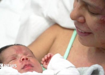 Terremoto en Venezuela: madre rescatada de los escombros con un bebé recién nacido le cuenta a la BBC cómo él la ayudó a sobrevivir