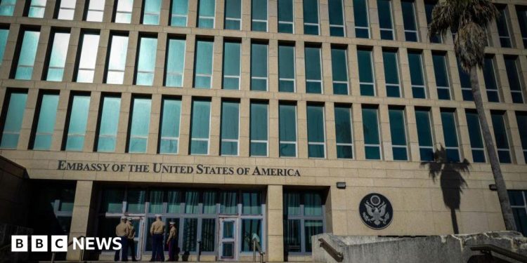 Havana Syndrome victims get $3m payout from US government Havana Syndrome victims get $3m payout from US government