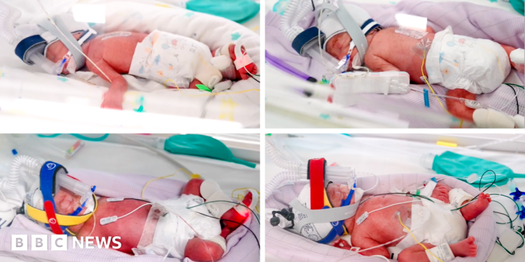Rare identical quadruplets born in Australia