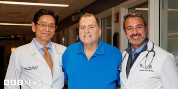 Pig kidney works in human body for 271 days - is this the future of organ transplants?