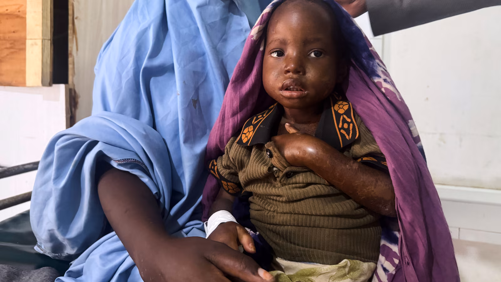 La caminata de tres días de una madre con su hija enferma pone de relieve la emergencia de desnutrición infantil en Somalia